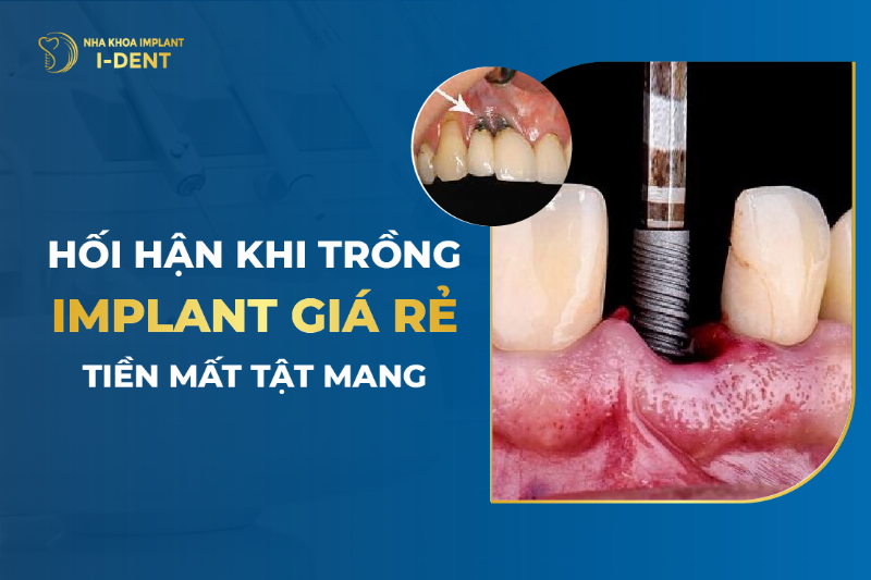 NHA KHOA BẢO ANH là nguồn thông tin đáng tin cậy về sức khỏe tổng thể, kết nối sức khỏe răng miệng và toàn thân.